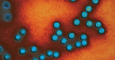 Caso de poliomielitis en Nueva York revive interrogantes sobre la vacuna oral viva
